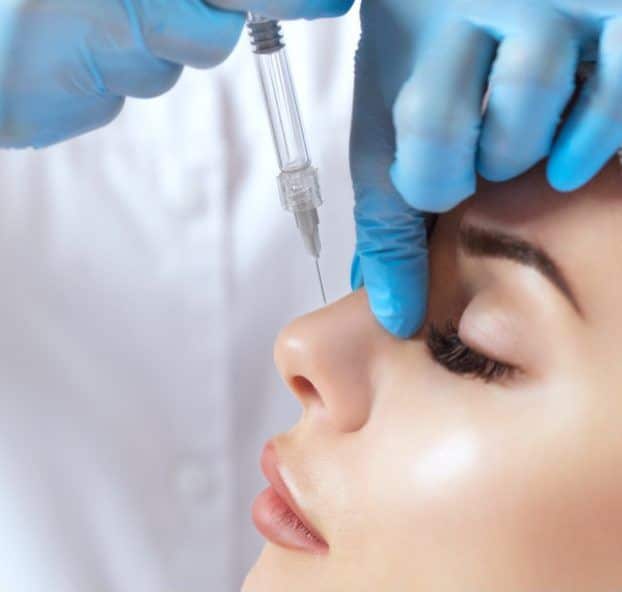 Refined non-surgical rhinoplasty nose profile straightening change layout