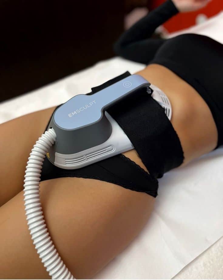 Firm, toned, and sculpted physique following non-surgical Emsculpt Neo body contouring session