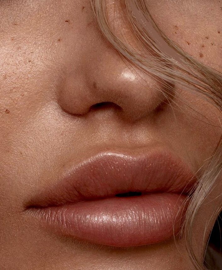 Soft, balanced, and perfectly defined natural lip filler enhancement results
