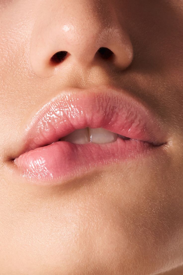 Clinical practitioner delivering precise micro-injections during soft lip hydration treatment session